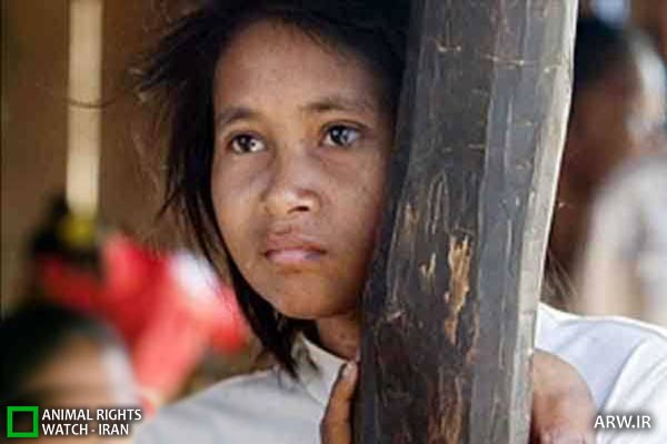 Feral child کودک وحشی